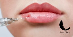 What to expect from dermal fillers